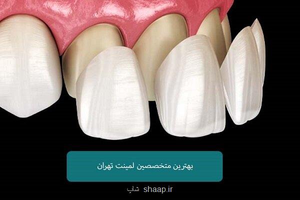 اسامی متخصصین لمینت دندان تهران
